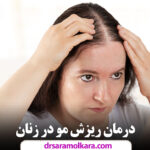 درمان ریزش مو در زنان